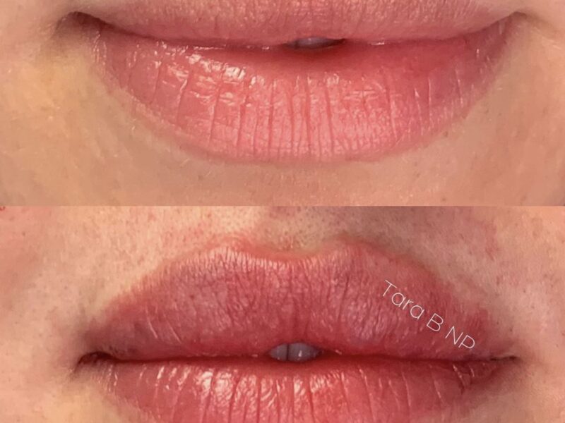 B-A-lips