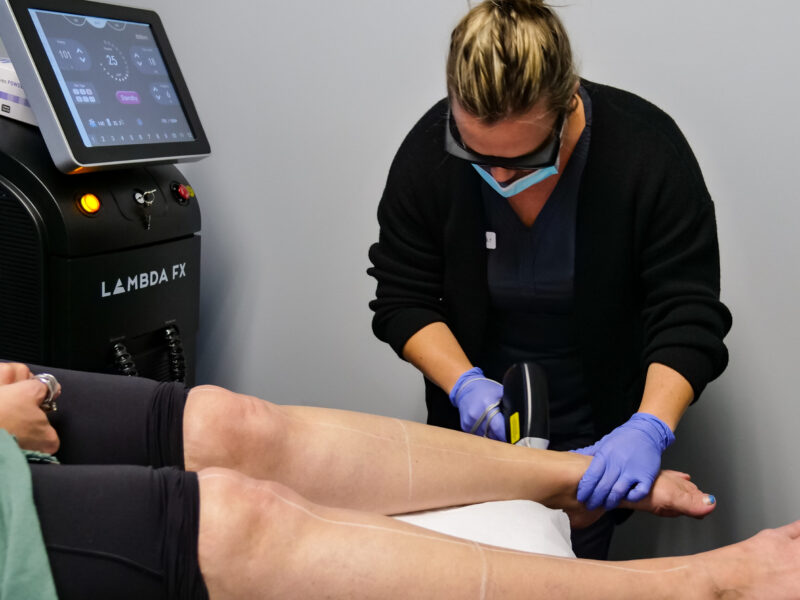 laser hair removal