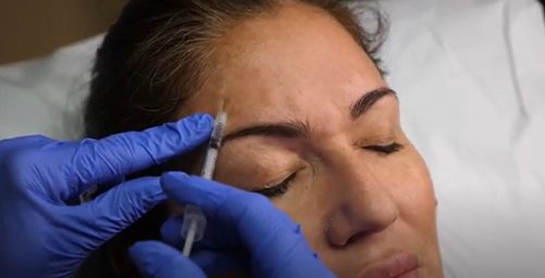 botox-or-dyport-cos