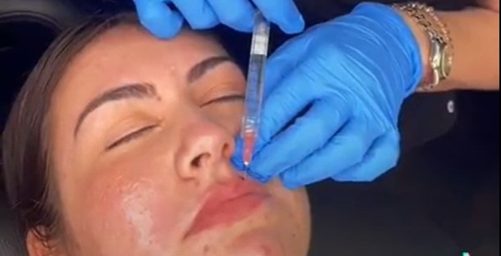 lip-injections
