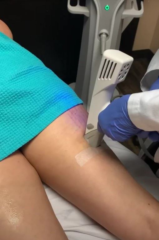Screenshot_12 Profound Cellulite Reduction