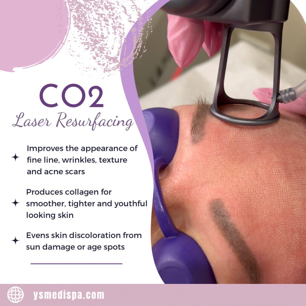 co2 new