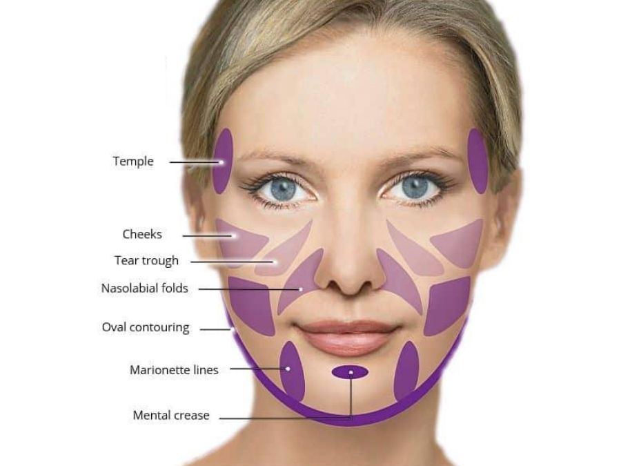Sculptra--2870118580