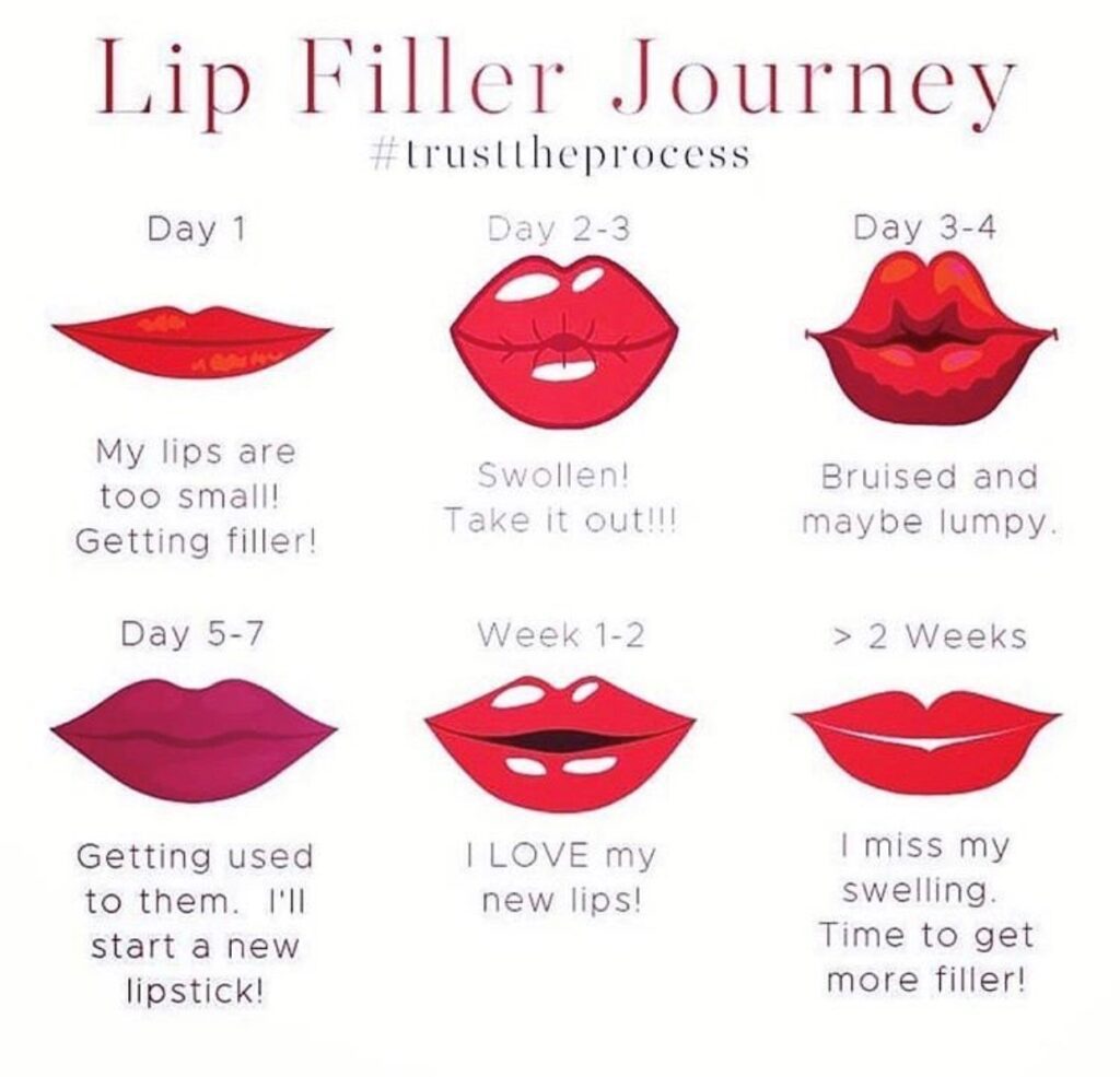 fille rjourney