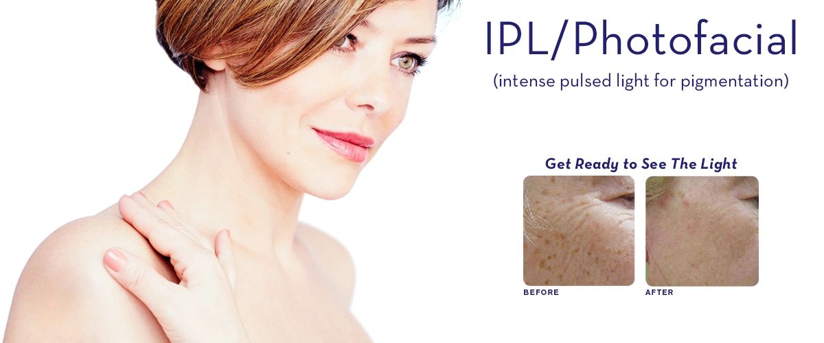 ipl-1-1426345365