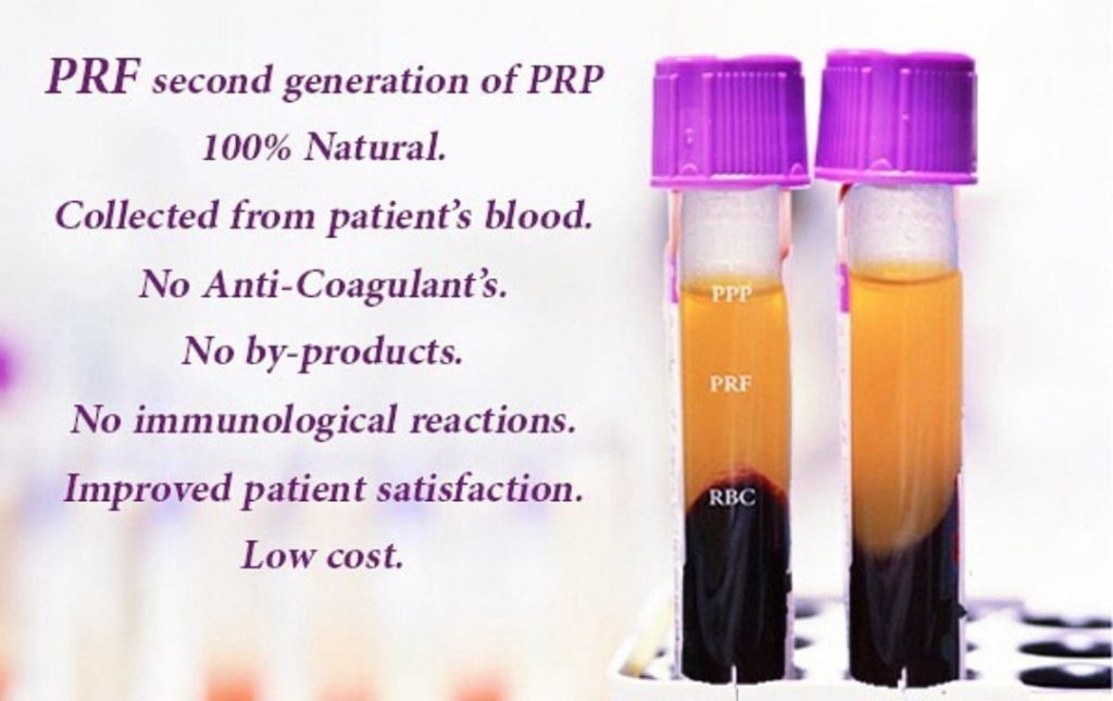 PRF 4