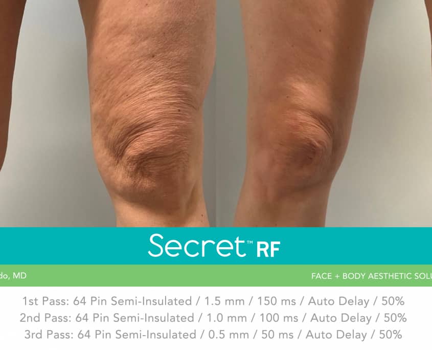 Secret-RF-B-A-Peredo-A-845x684-3486089849