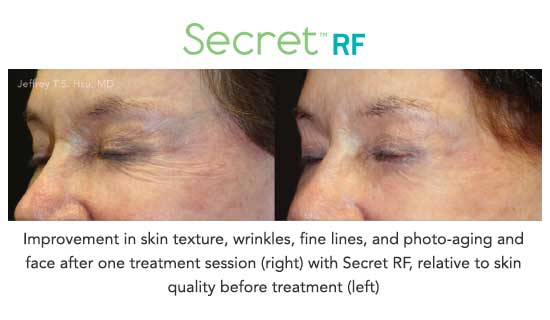 secret4